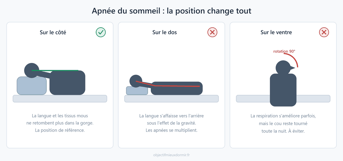 Apnée du sommeil : l'effet de la position de sommeil sur les voies respiratoires