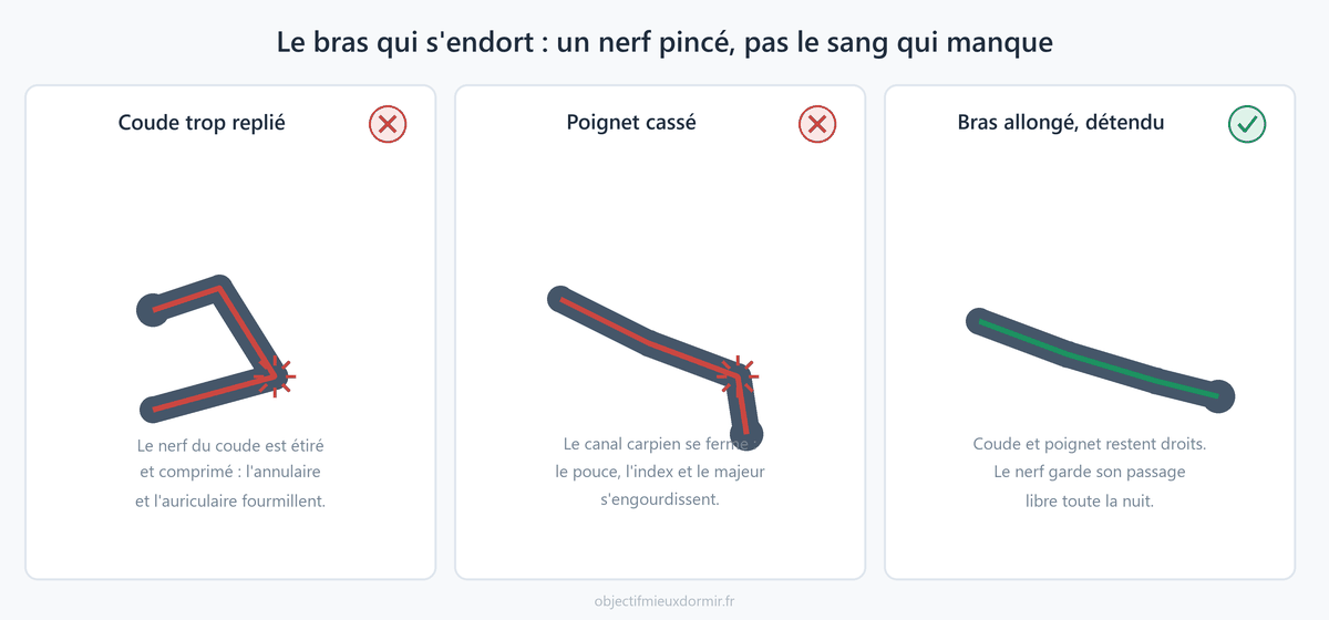 Ce n'est pas le sang qui manque, c'est un nerf pincé. Bras coincé sous le corps, coude ou poignet trop pliés : la position ferme le passage. Bras allongé et détendu : il reste libre.