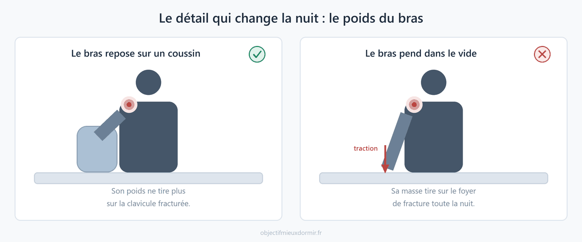 Clavicule cassée : le bras doit reposer sur un coussin et non pendre dans le vide