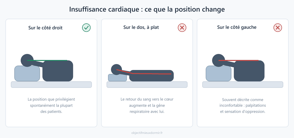 Insuffisance cardiaque : l'effet de la position de sommeil