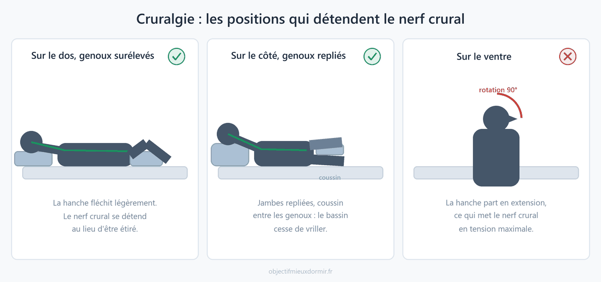 Cruralgie : les positions de sommeil qui détendent le nerf crural