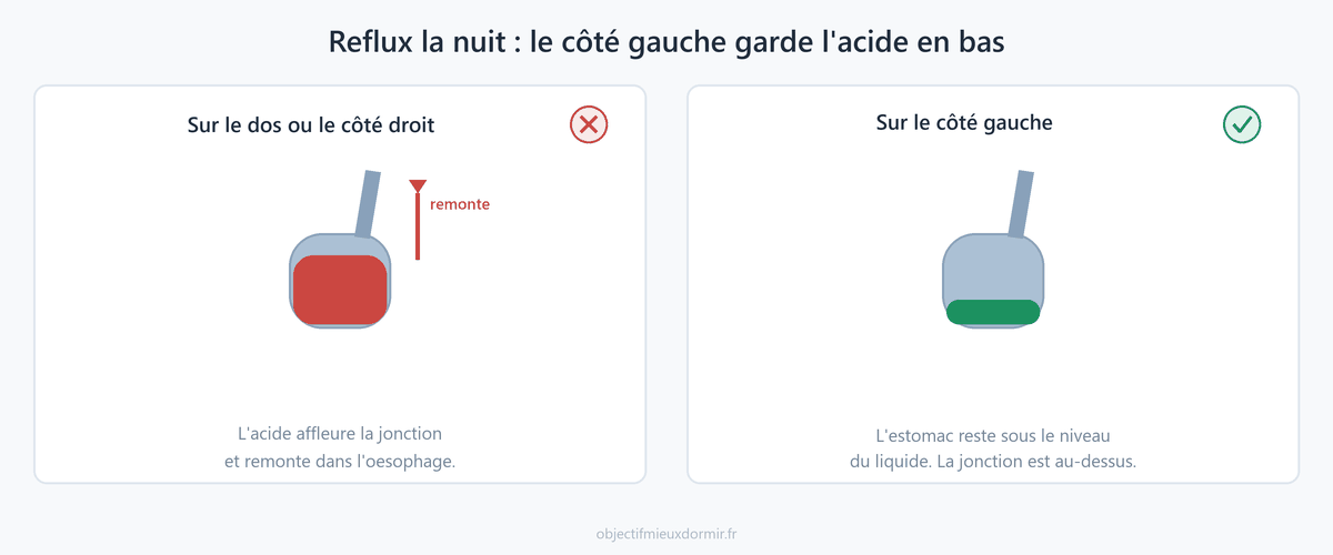 Sur le dos ou sur le côté droit, l'acide de l'estomac affleure la jonction avec l'oesophage. Sur le côté gauche, l'estomac reste sous le niveau du liquide.