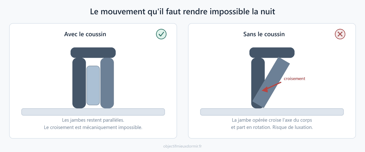 Prothèse de hanche : le coussin entre les jambes empêche le croisement et la rotation interne
