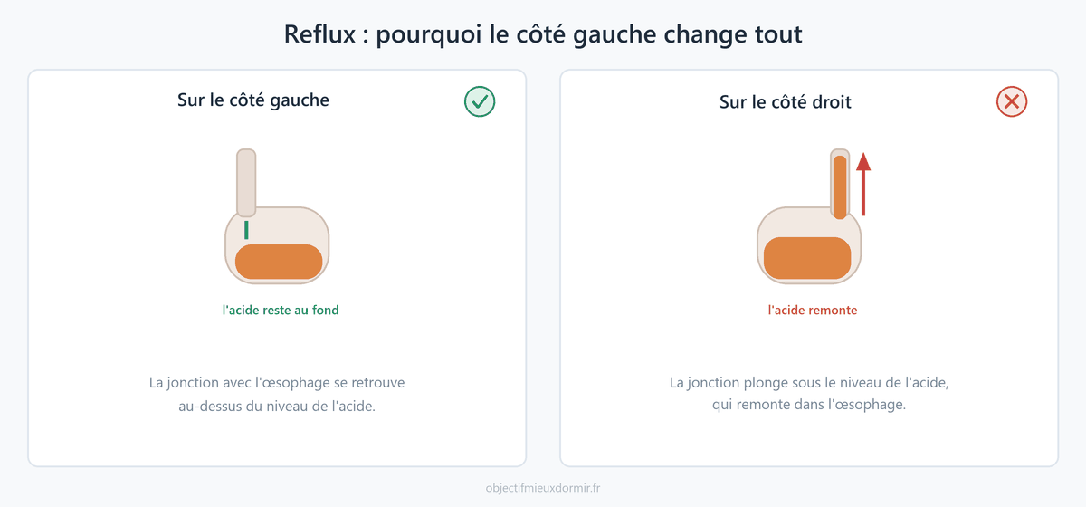 Reflux : pourquoi dormir sur le côté gauche empêche l'acide de remonter