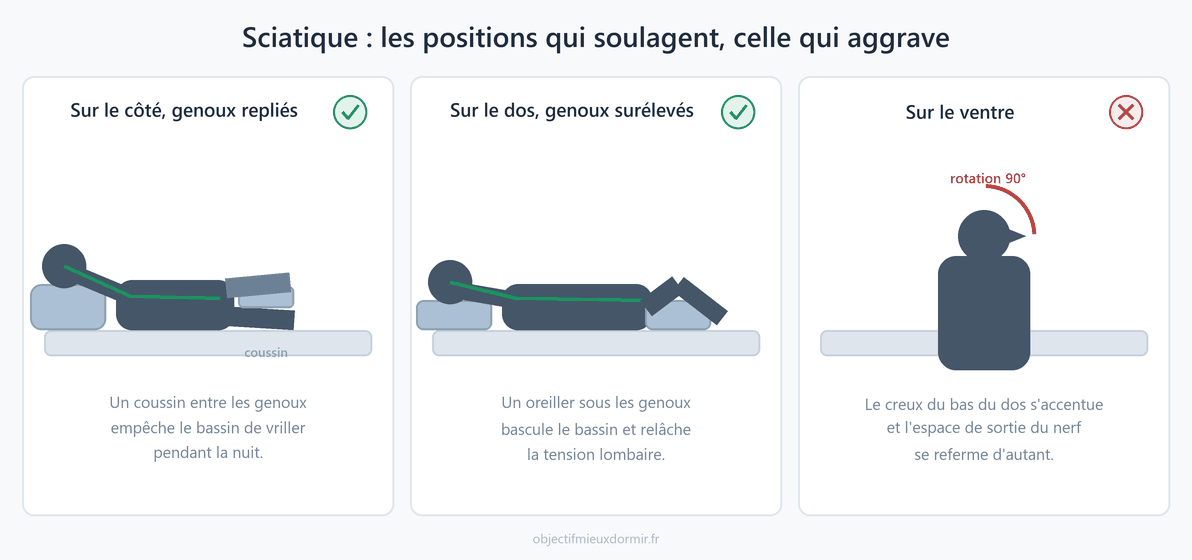 Les positions de sommeil qui soulagent la sciatique et celle qui l'aggrave